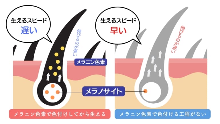 【白髪が生えると頭皮がかゆい理由】痒みの原因と対処法を紹介 | 白髪染め専門美容室ソマリ